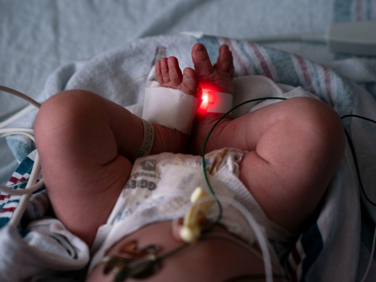 The legs and feet of a newborn baby in the hospital