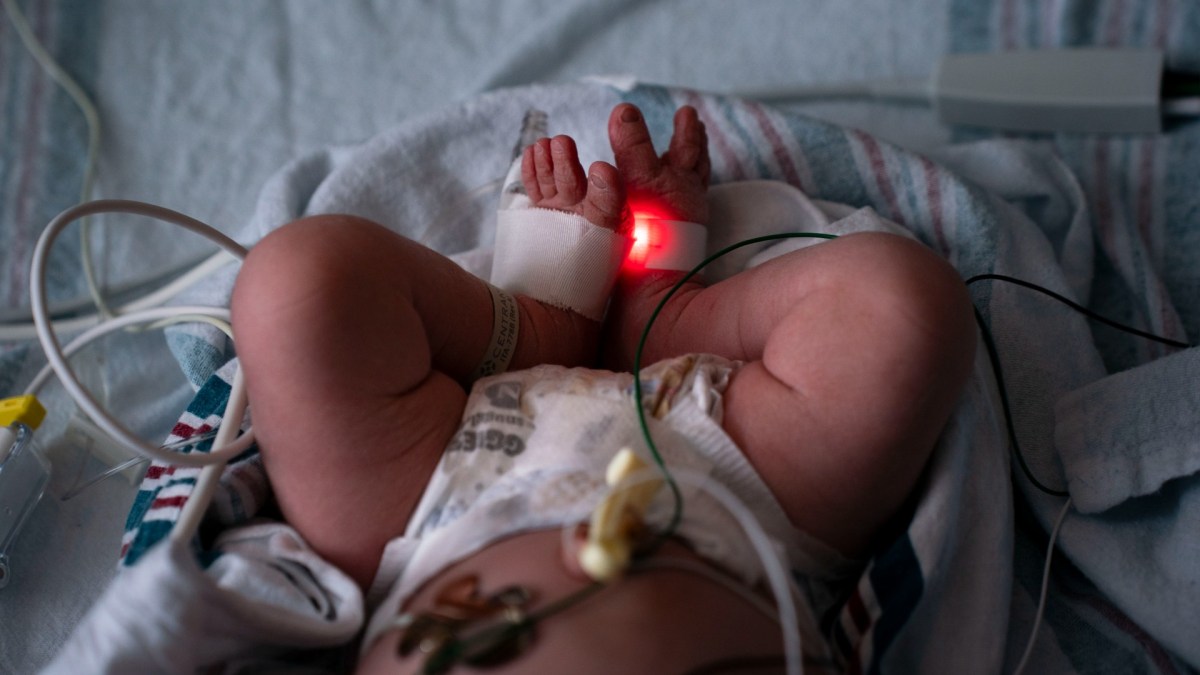 The legs and feet of a newborn baby in the hospital